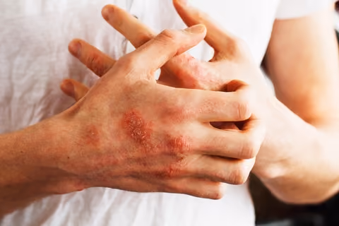 Lupus is one of the common causes of muscle pain.