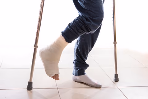 The loss of motion is a common sign and symptom of broken bones.