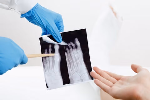 Deformity is a common sign and symptom of broken bones.