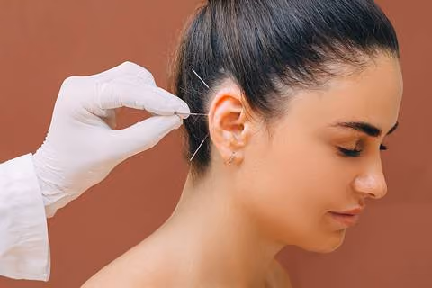 Type #4: Auricular Acupuncture