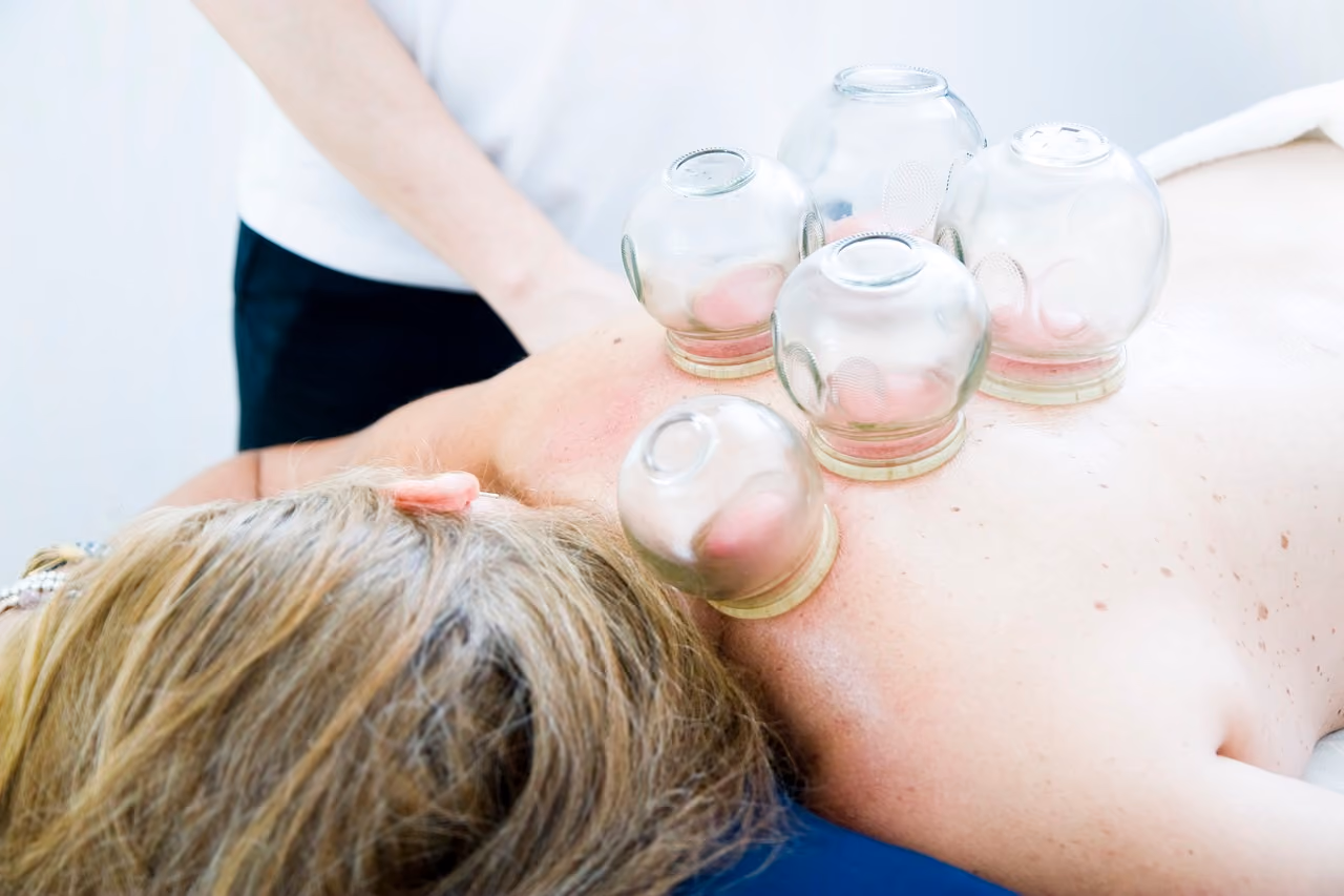 3 Reasons to Try Cupping Therapy