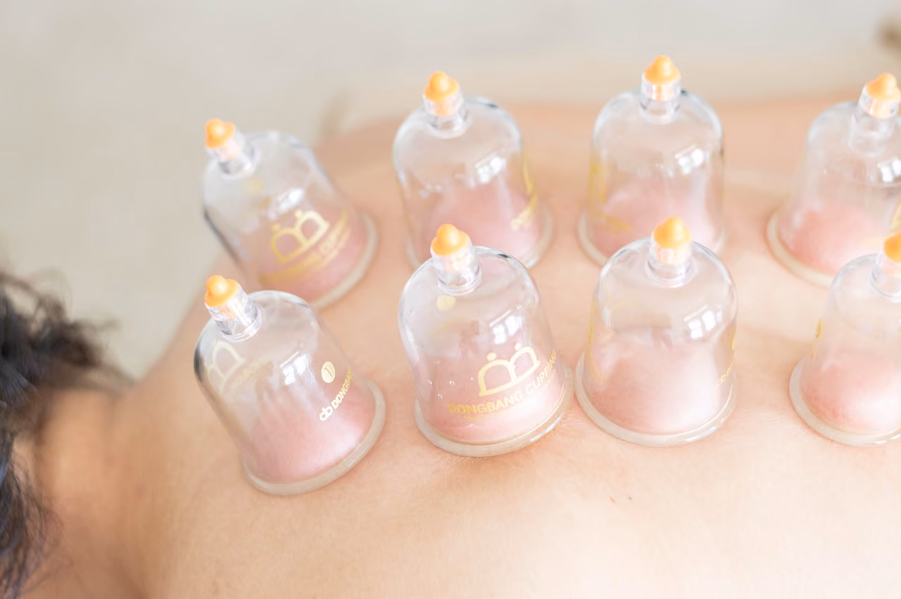 What is Cupping Massage?