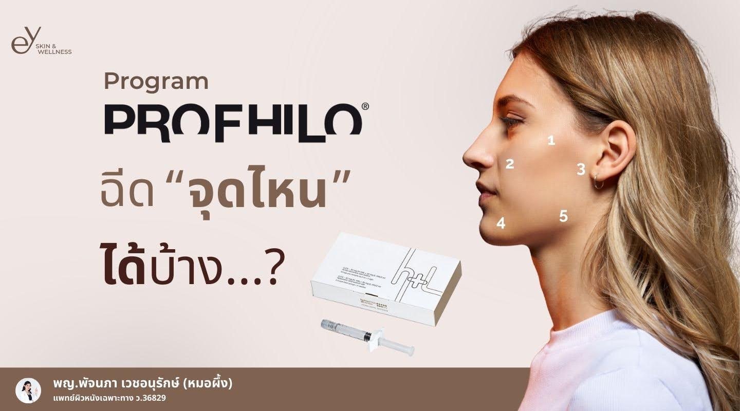 Profhilo คืออะไร ฉีดจุดไหนได้บ้าง 