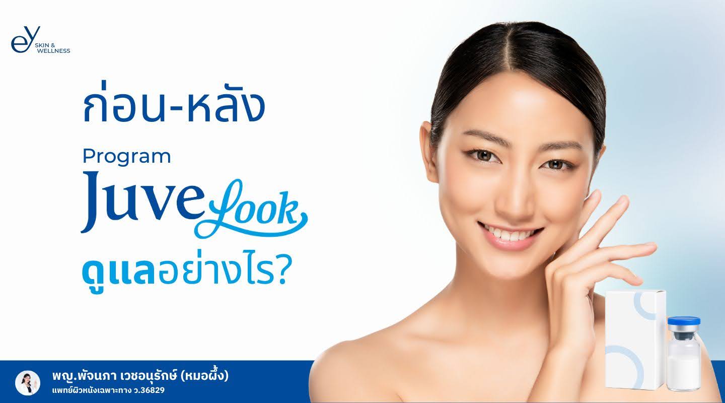 ก่อน-หลังฉีด Juvelook ต้องดูแลผิวอย่างไร ห้ามทำอะไรบ้าง? 