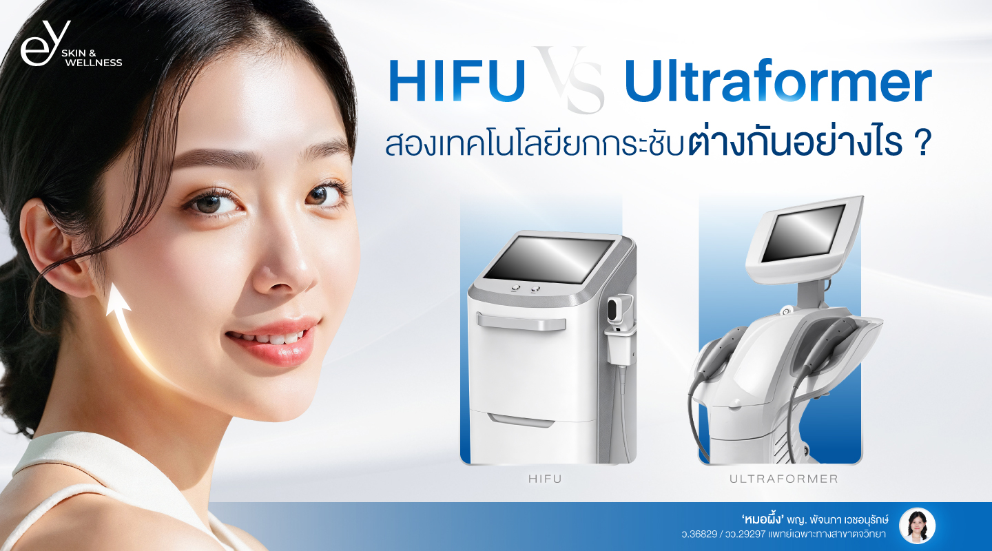 เปรียบเทียบ HIFU vs Ultraformer สองเทคโนโลยียกกระชับต่างกันอย่างไร?