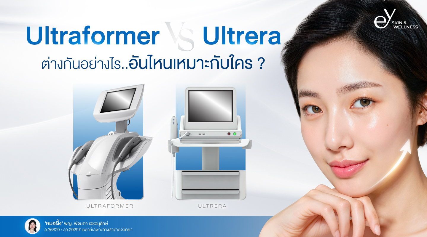 Ultraformer vs Ulthera ต่างกันอย่างไร? อันไหนดีกว่ากัน?