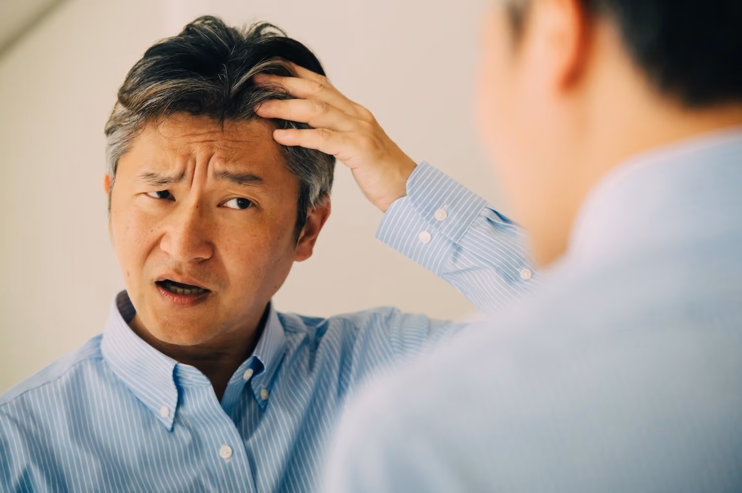 生え際の脱毛を気にする男性