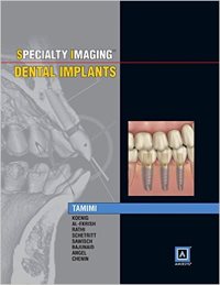 Specialty Imaging: Dental Implants, 1st Edition cover