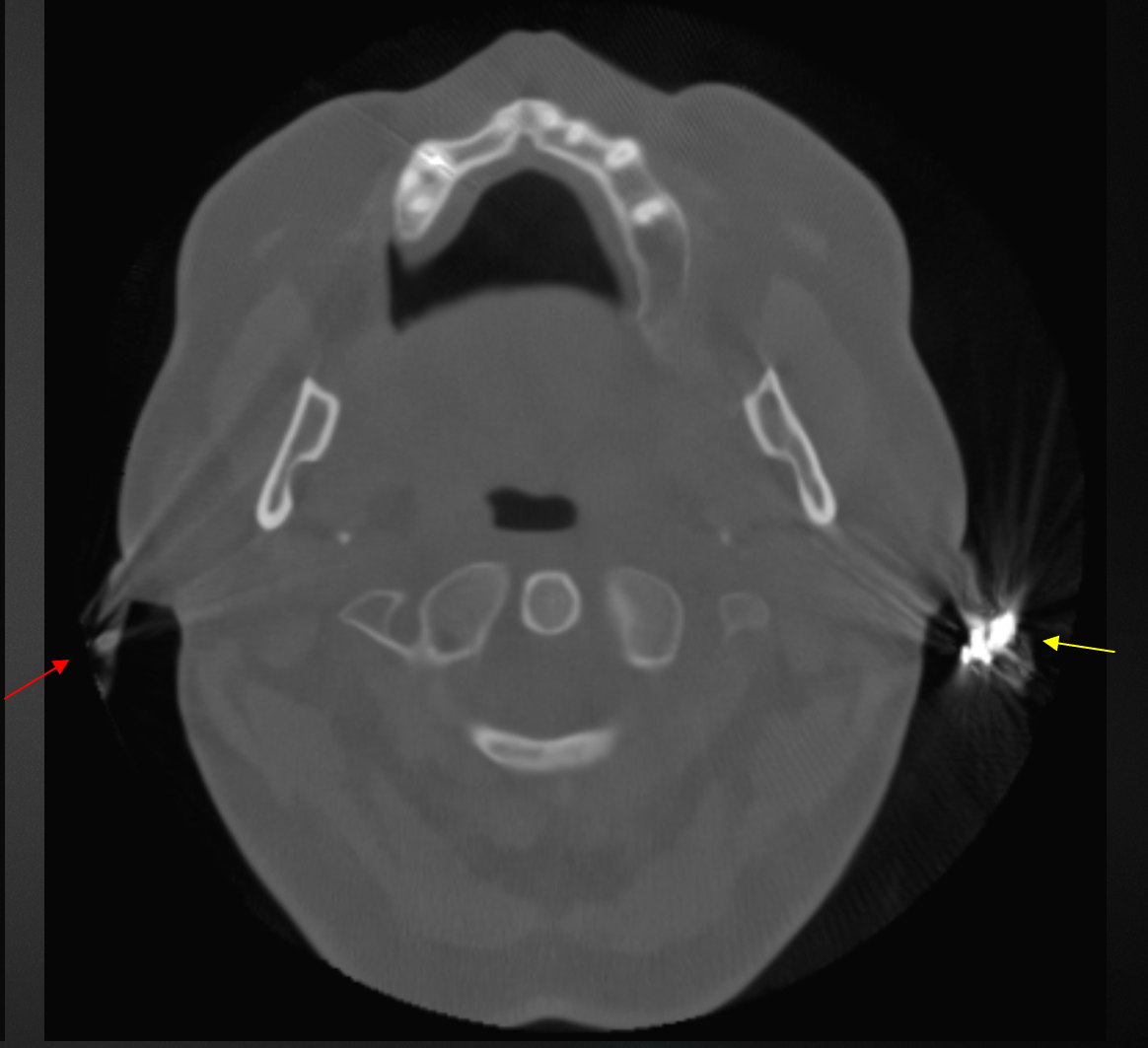 De-identified scan figure