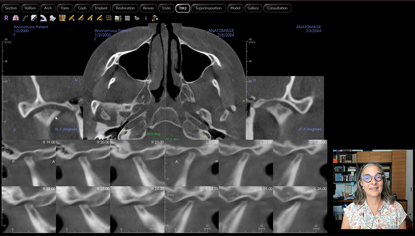 Inside the Read: How an OMR Reads a CBCT