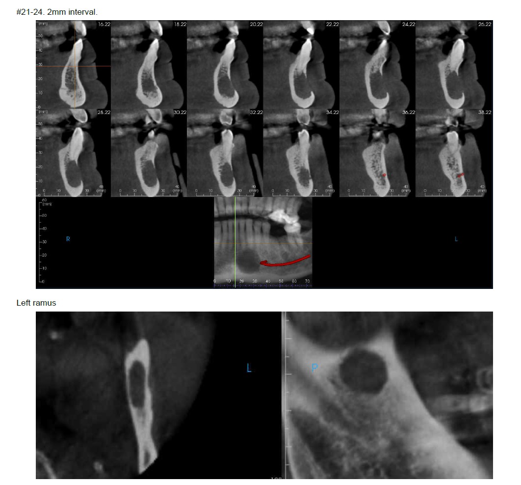 De-identified scan figure