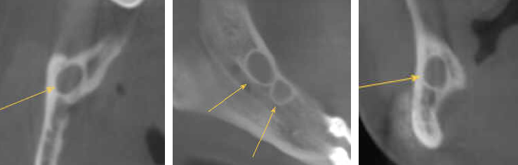 De-identified scan figure