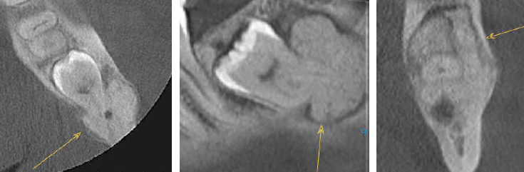 De-identified scan figure