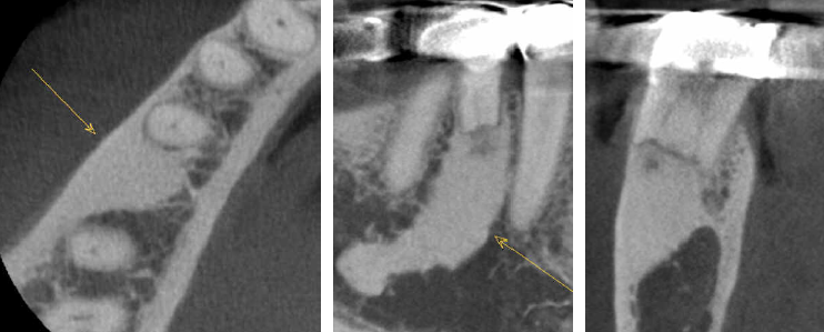 De-identified scan figure