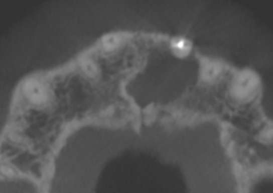 De-identified scan figure