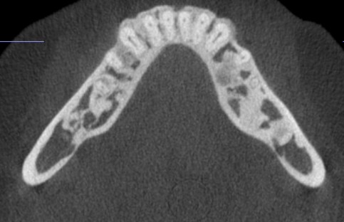 De-identified scan figure