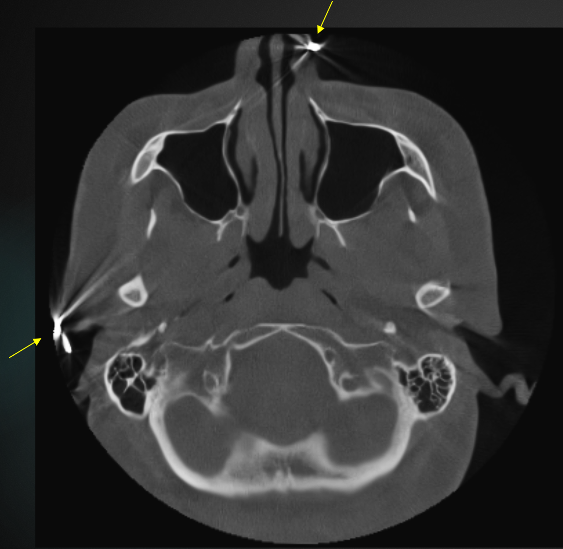 De-identified scan figure