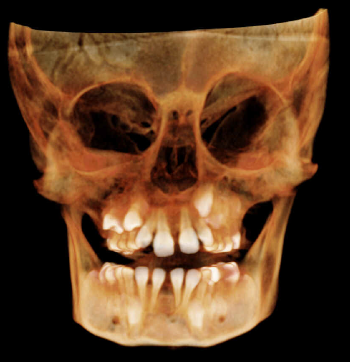 De-identified scan figure