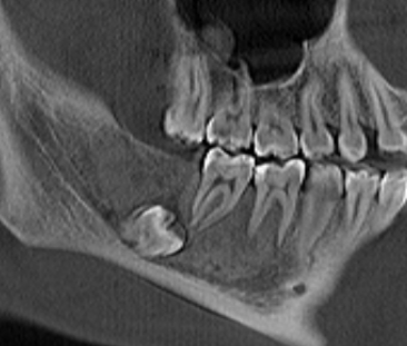 De-identified scan figure