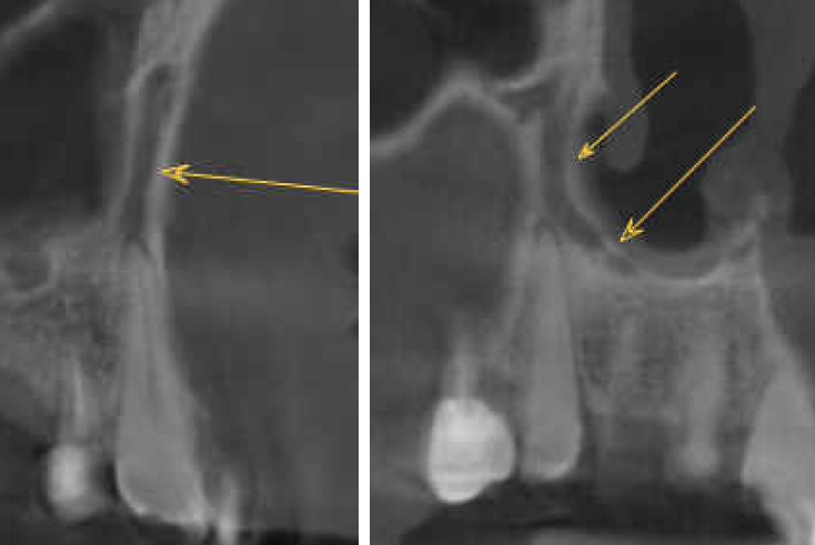 De-identified scan figure
