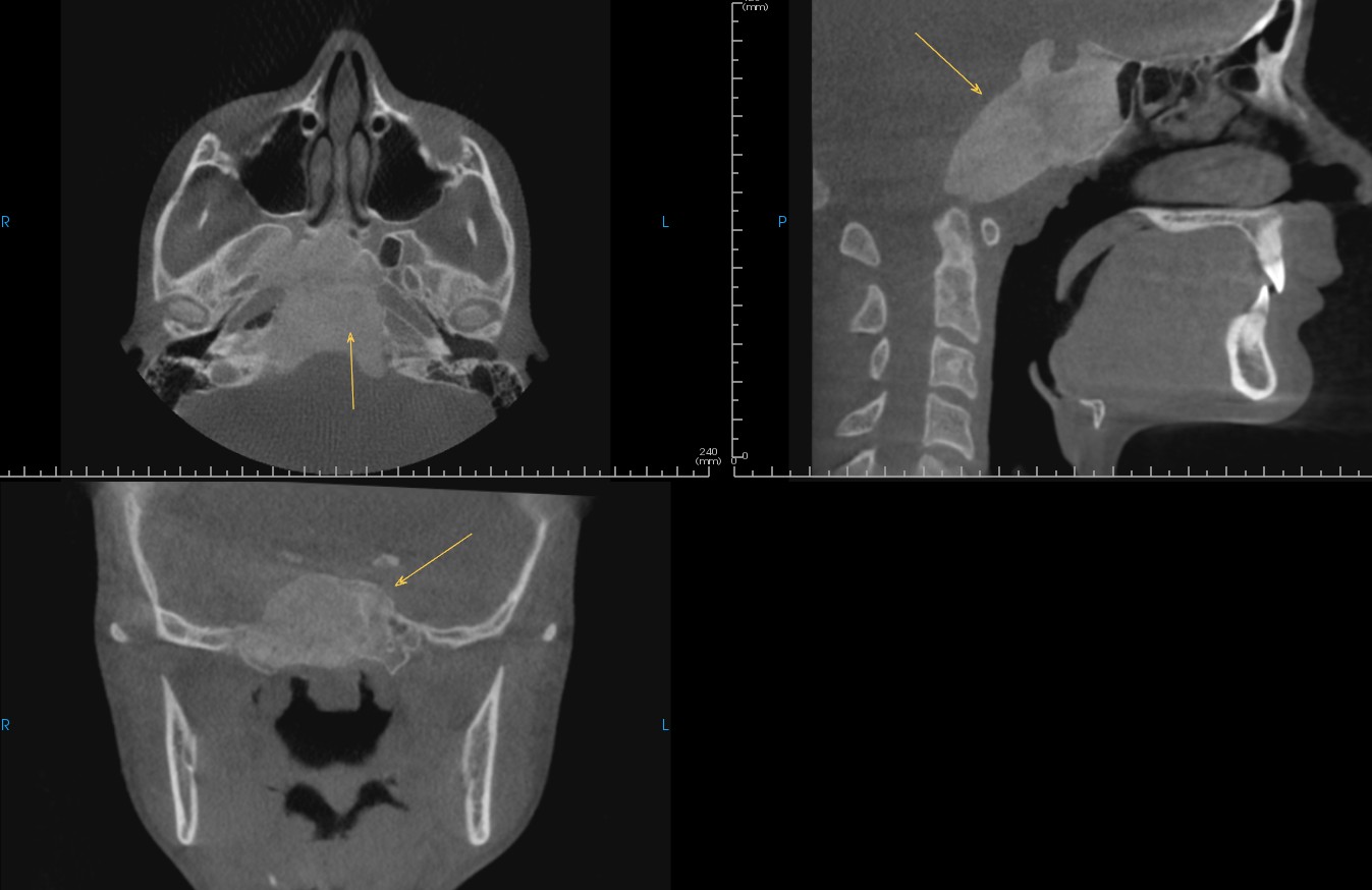 De-identified scan figure