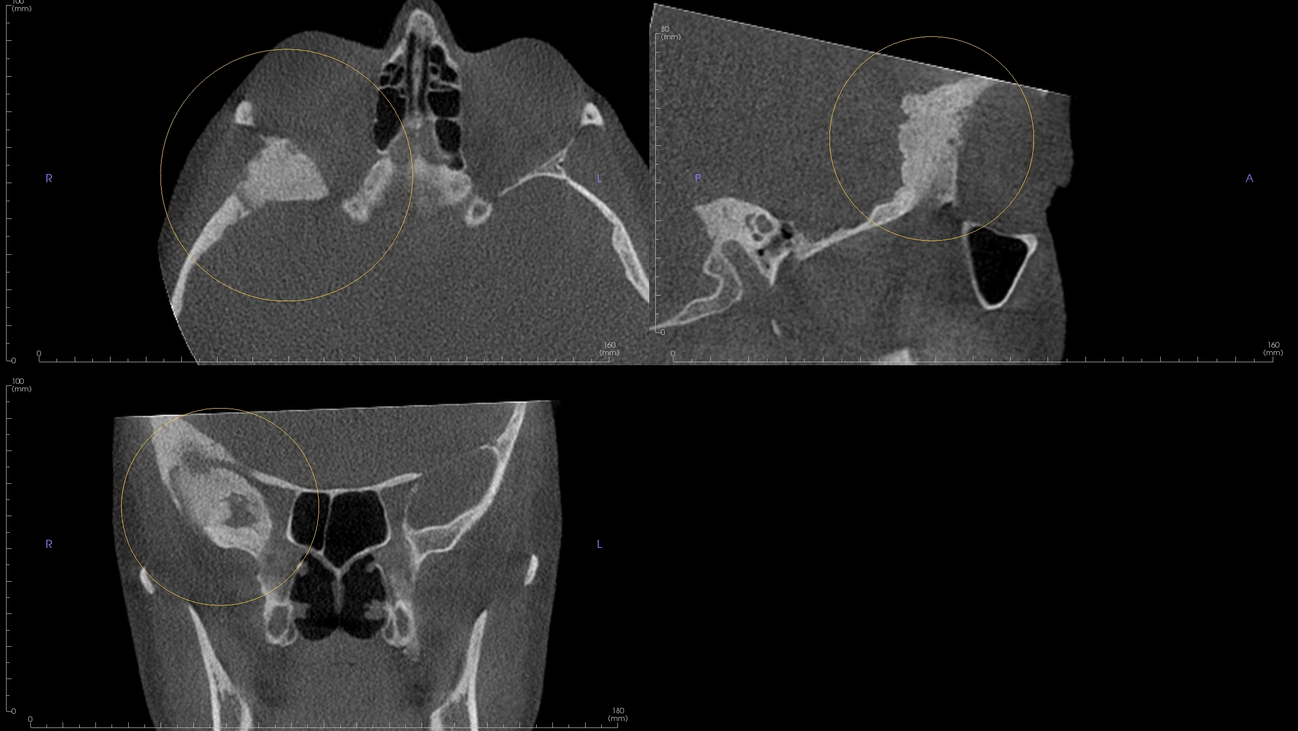 De-identified scan figure