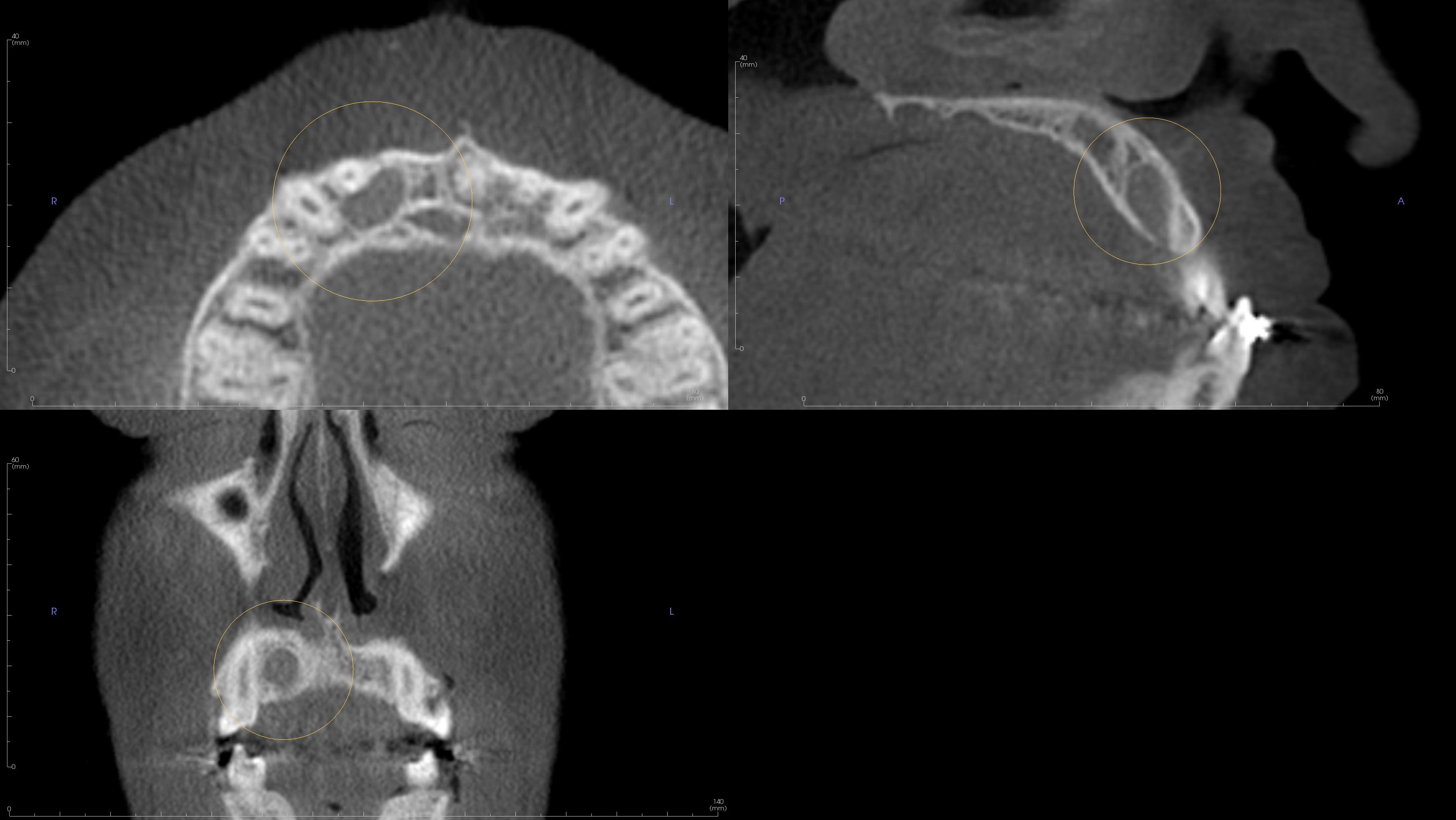 De-identified scan figure