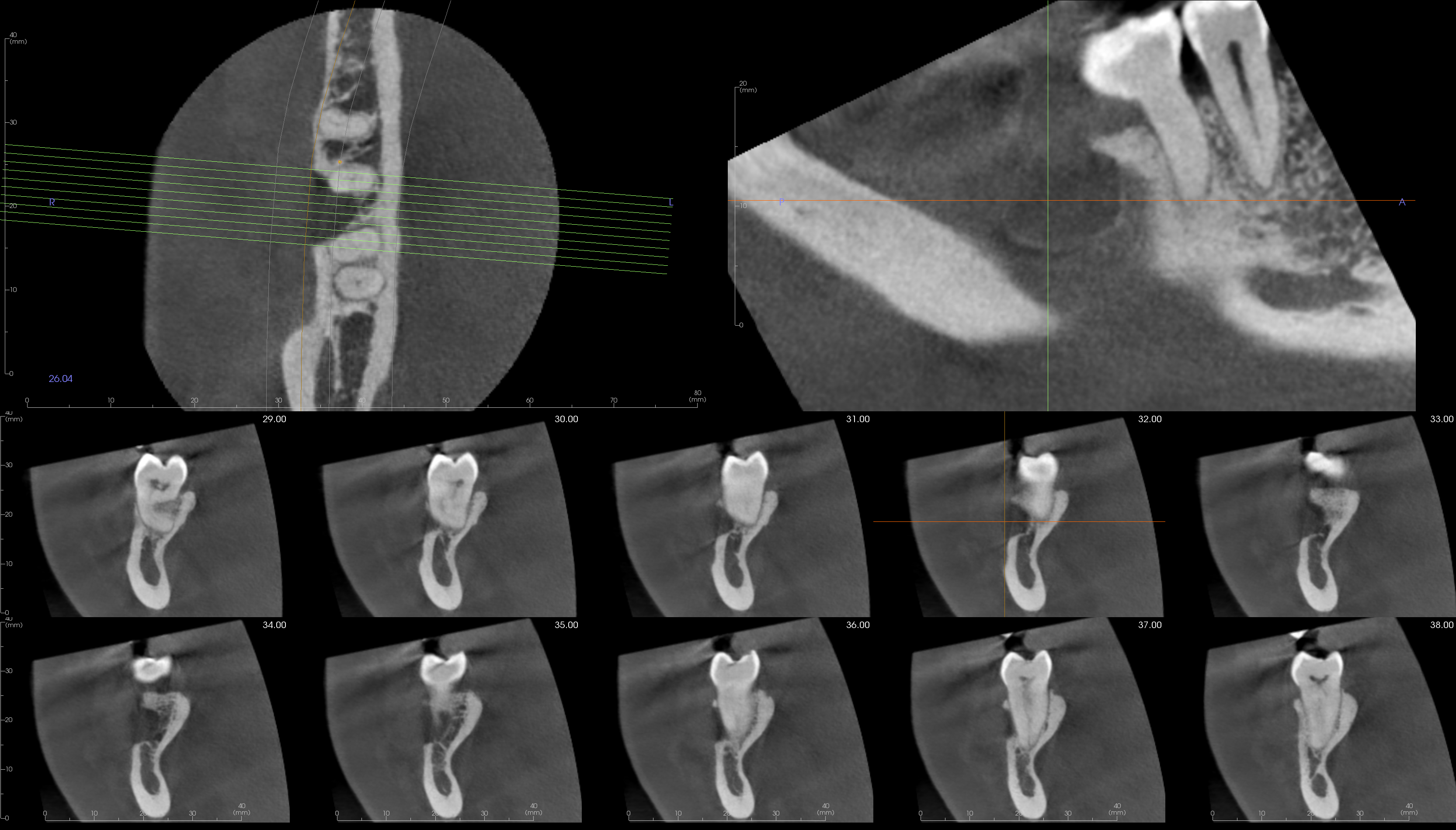De-identified scan figure