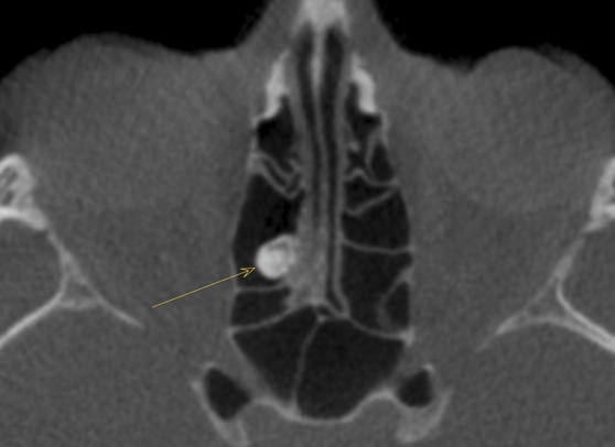 De-identified scan figure