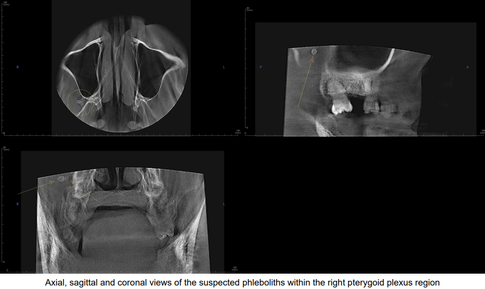De-identified scan figure