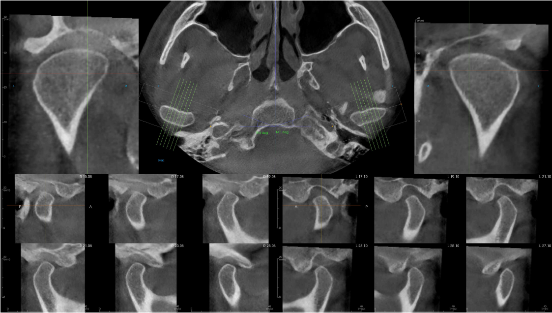 De-identified scan figure