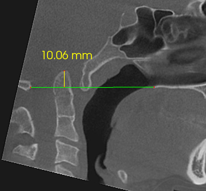 De-identified scan figure