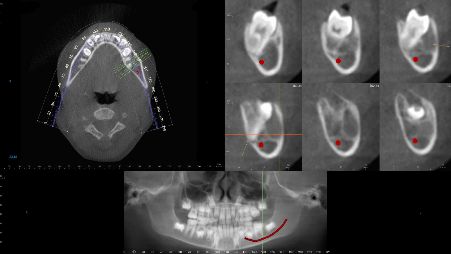 De-identified scan figure