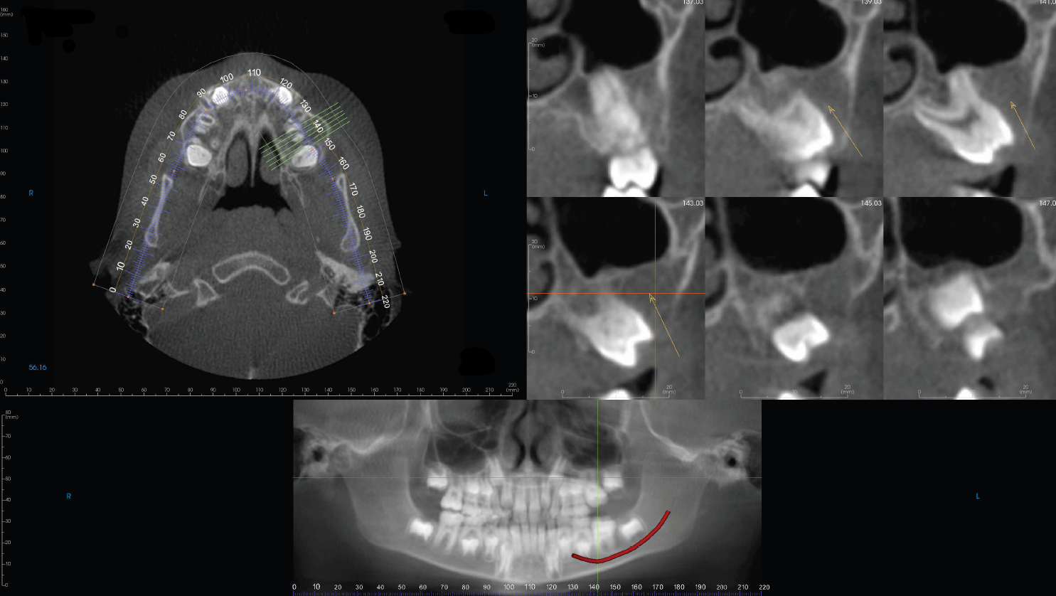 De-identified scan figure