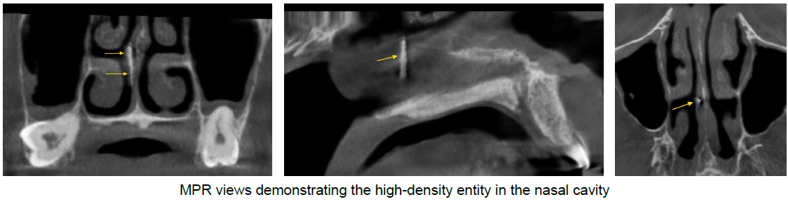 De-identified scan figure