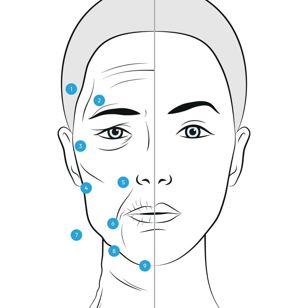 What Age Is Too Young for a Deep Plane Facelift?