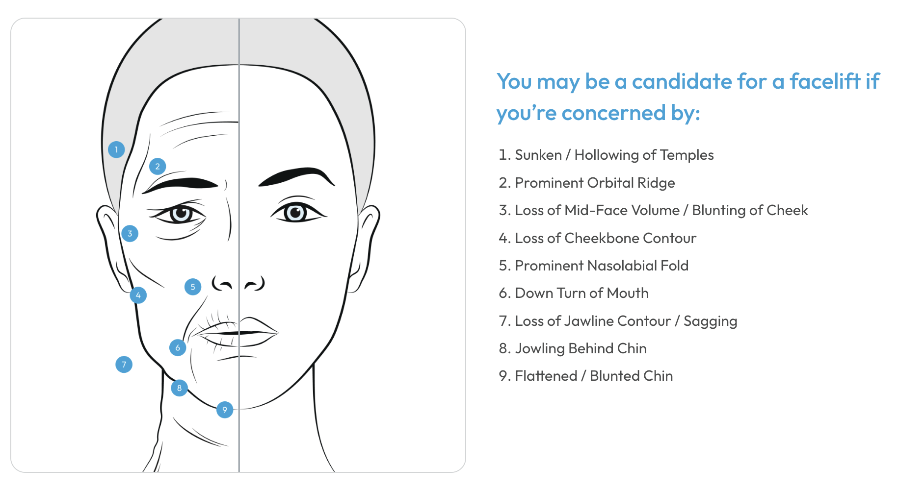 Am I a candidate for a facelift?