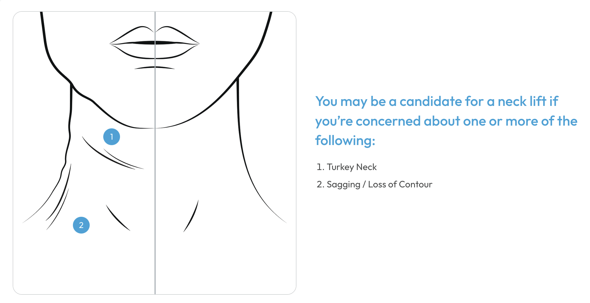 Am I a candidate for a neck lift?