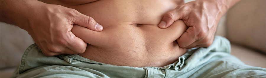 Obesity
