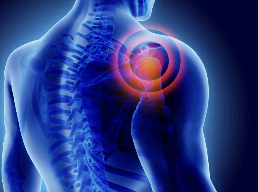 5 Signs It’s Time to Seek Professional Help for Your Shoulder Pain in Buffalo