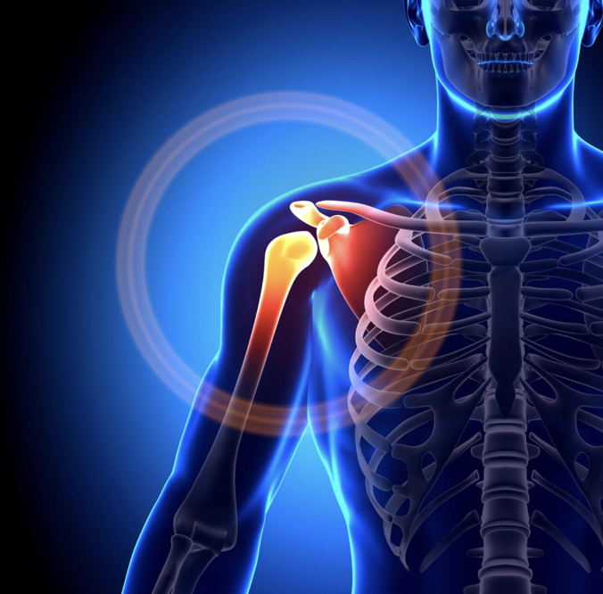 Why Does My Shoulder Hurt at Night? Common Causes and Proven Relief Options