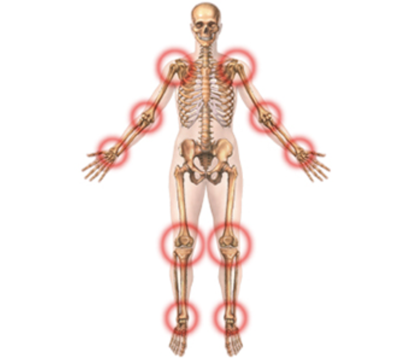 Why Joint Pain Seems to “Move Around” Your Body