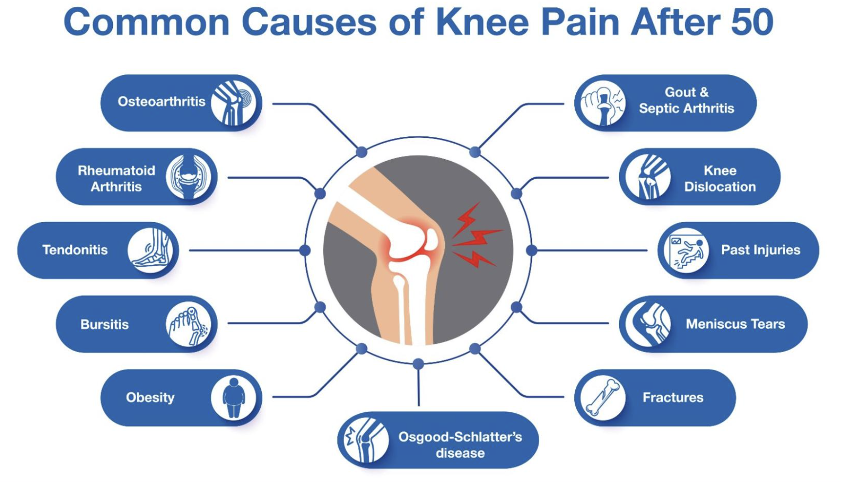 What Age Does Knee Arthritis Usually Start?