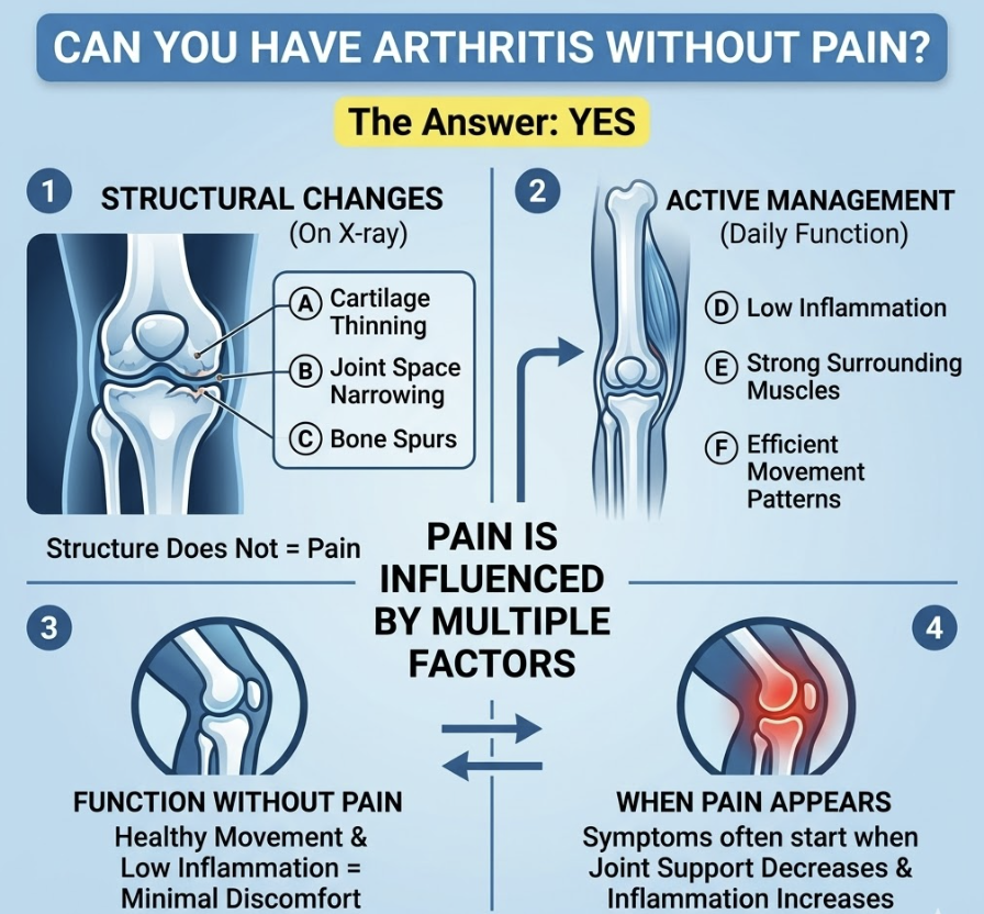 Can You Have Arthritis Without Pain?