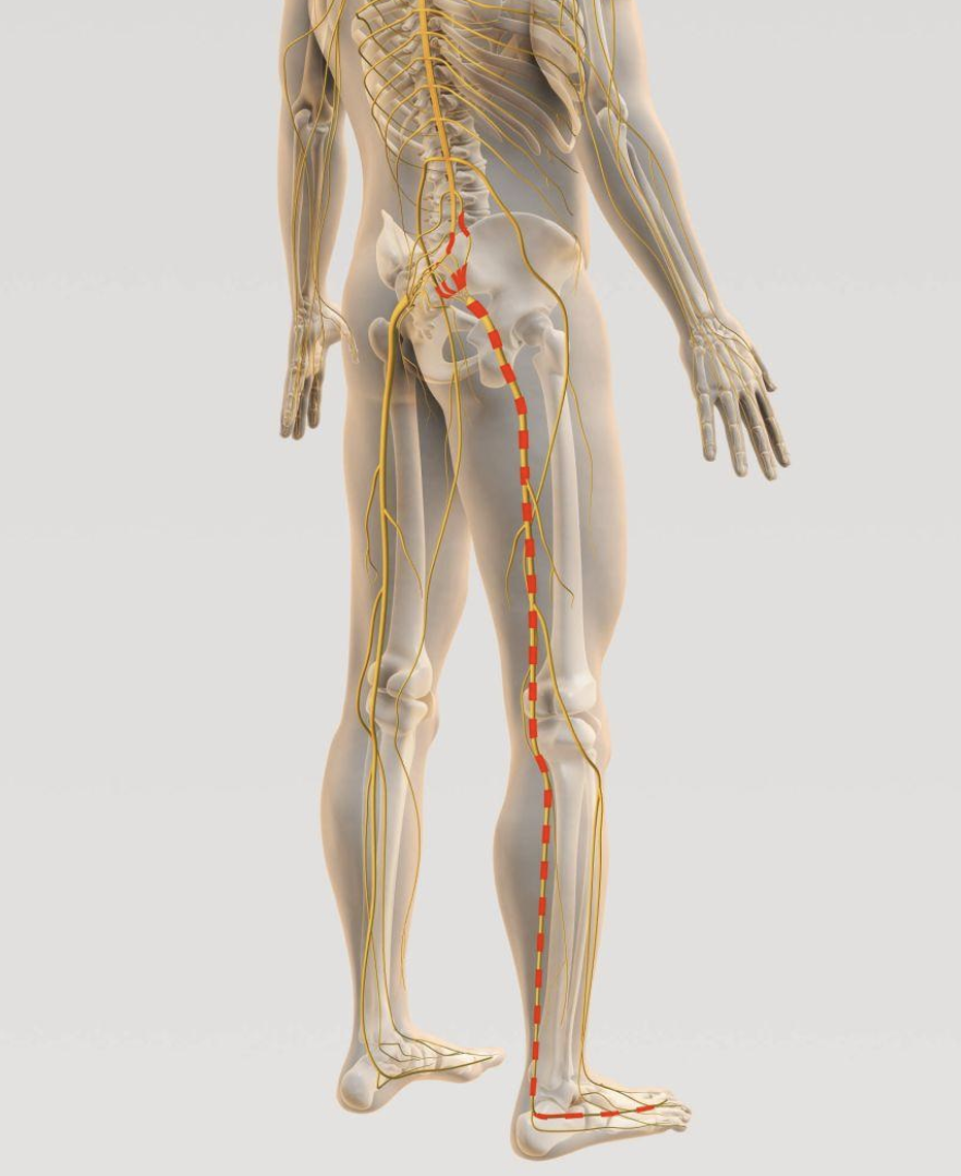 Why One Foot Goes Numb But the Other Doesn't