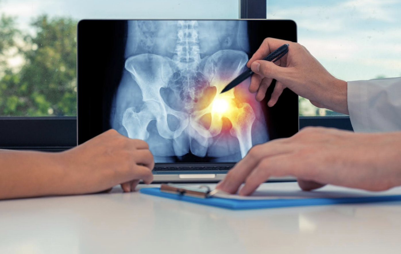 Does Chronic Hip Pain Always Lead to Hip Replacement?