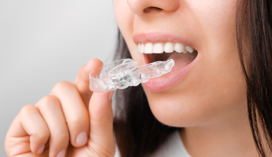 Woman putting on aligners