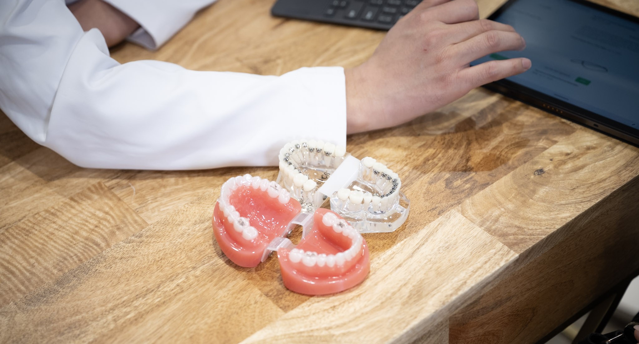 InSmile Braces versus Invisalign