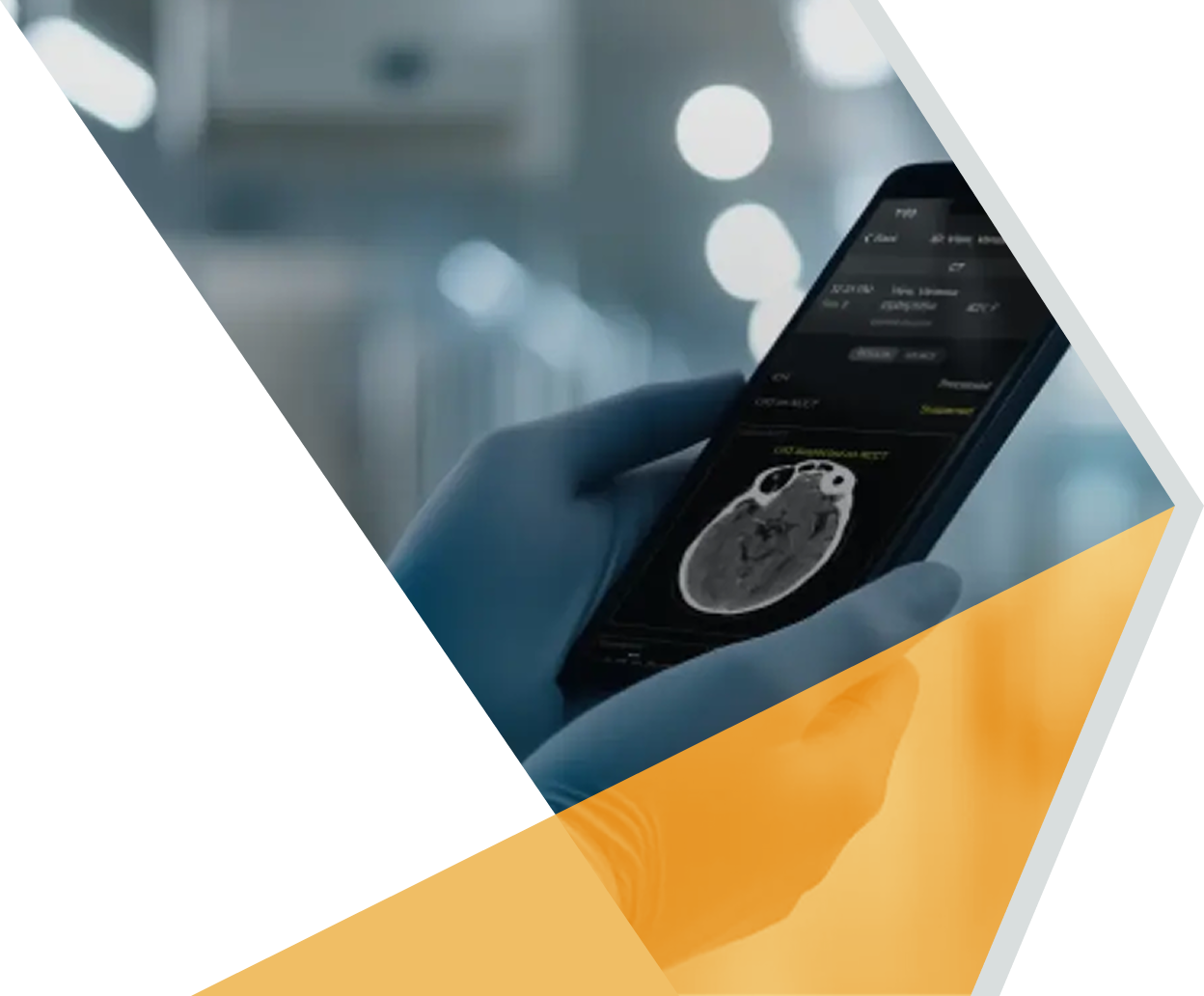 RapidAI delivers reliable clinical AI across thousands of hospitals worldwide