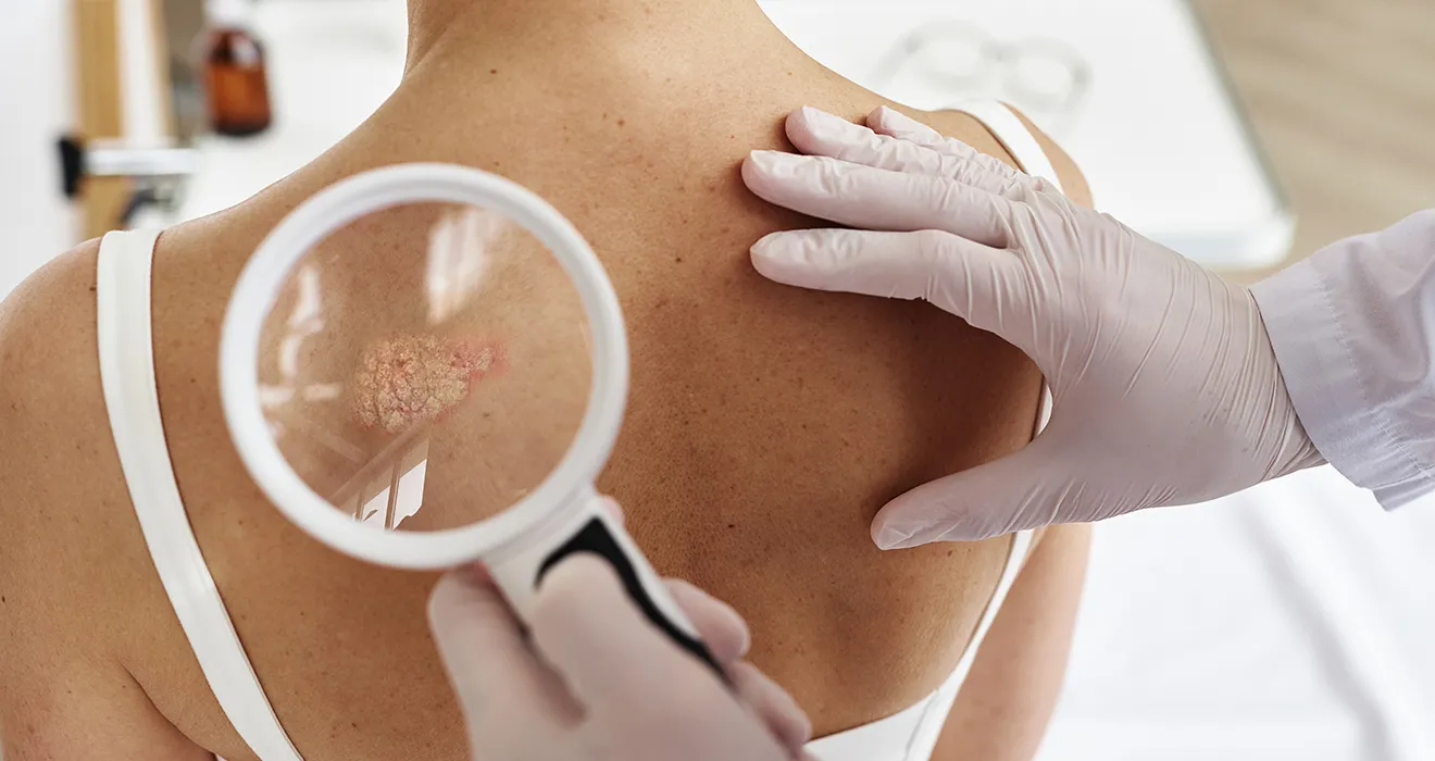Temas em alta na dermatologia: o que você precisa saber para cuidar da sua pele com segurança